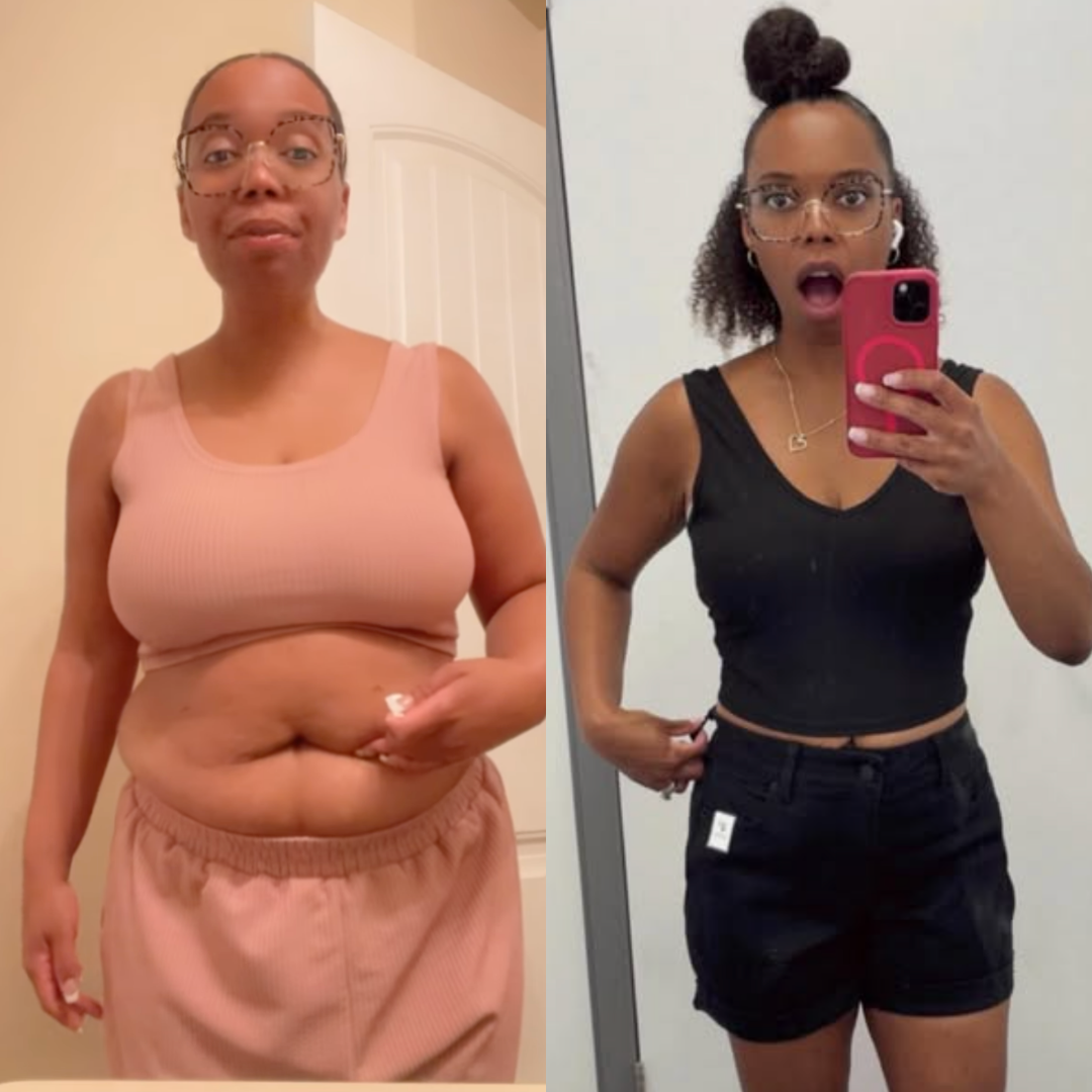 Before and after weight loss transformation